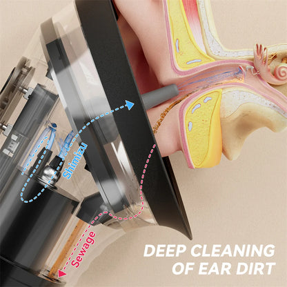 Electric Ear Wax Removal System